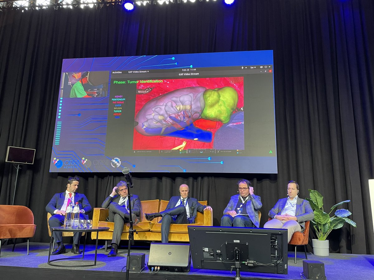 Angelo Mottaran (@angelomottaran) on Twitter photo Robotic partial nephrectomy with real time AI & AR analysis and automatic alignment performed by <a href="/alexmottrie/">Alex Mottrie</a> from AZORG Hospital, Aalst and moderated by <a href="/riccardoschiav6/">riccardo schiavina</a> and <a href="/bernardorocco73/">Bernardo Rocco, MD,FRCS (Glasgow)</a>
Huge effort and congratulation to <a href="/pidebacker/">Pieter De Backer</a> and ORSI_Innotech team Robotic partial nephrectomy with real time AI & AR analysis and automatic alignment performed by <a href="/alexmottrie/">Alex Mottrie</a> from AZORG Hospital, Aalst and moderated by <a href="/riccardoschiav6/">riccardo schiavina</a> and <a href="/bernardorocco73/">Bernardo Rocco, MD,FRCS (Glasgow)</a>
Huge effort and congratulation to <a href="/pidebacker/">Pieter De Backer</a> and ORSI_Innotech team