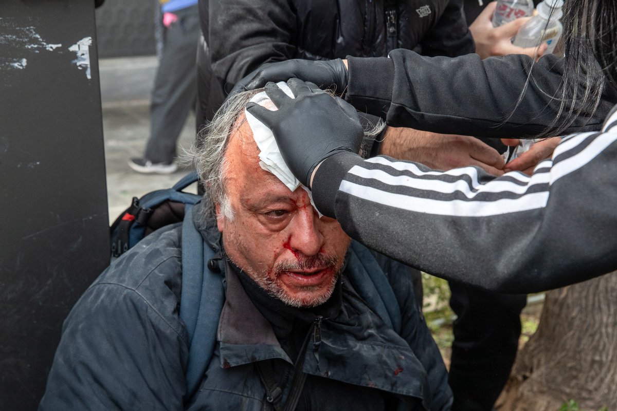 lolosmarios's tweet image. Ο συνάδελφος Ορέστης Παναγιώτου τραυματισμένος από κρότου λάμψης στο κεφάλι. Βγαίνει από το νοσοκομείο με μειωμένη ακοή αφού τον έραψαν πρώτα.