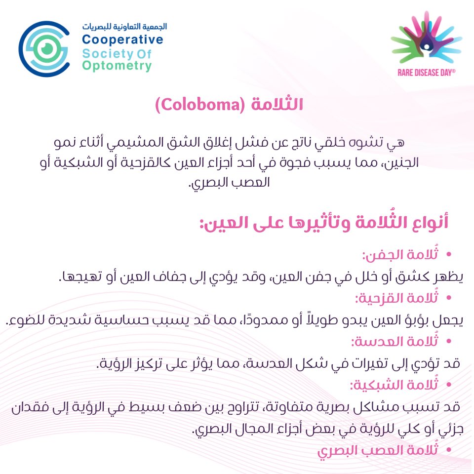 الجمعية التعاونية للبصريات tweet media