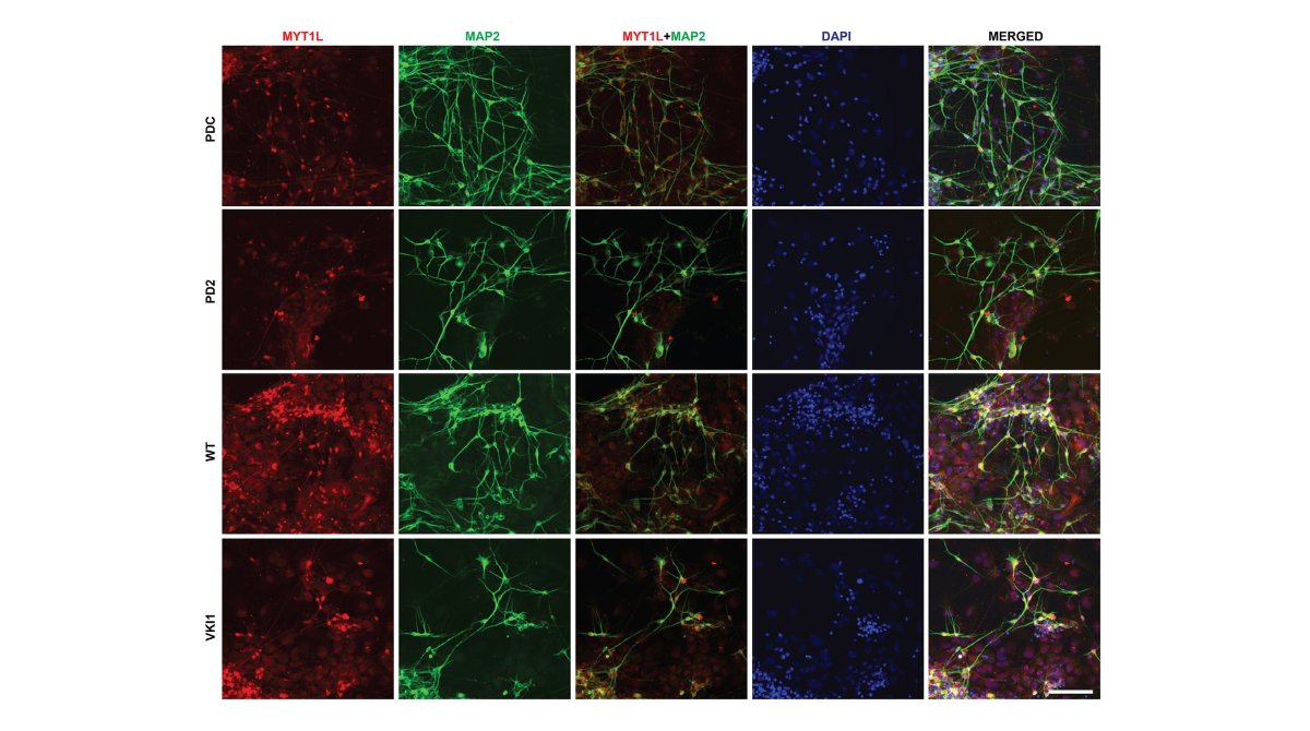 stemcellreports's tweet image. New study on #autism and #intellectualdisability highlights the impact of MYT1L mutation on human cortical interneurons, altering #differentiation, maturation, #synapse formation &amp;amp; more.  
@washumedicine @WashUDevBio @ISSCR @GairdnerAwards @SickKidsNews  

ow.ly/hOAU50V8mtB