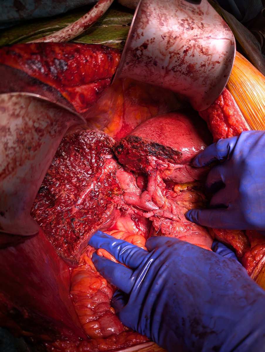 Chris Nahm tweet media