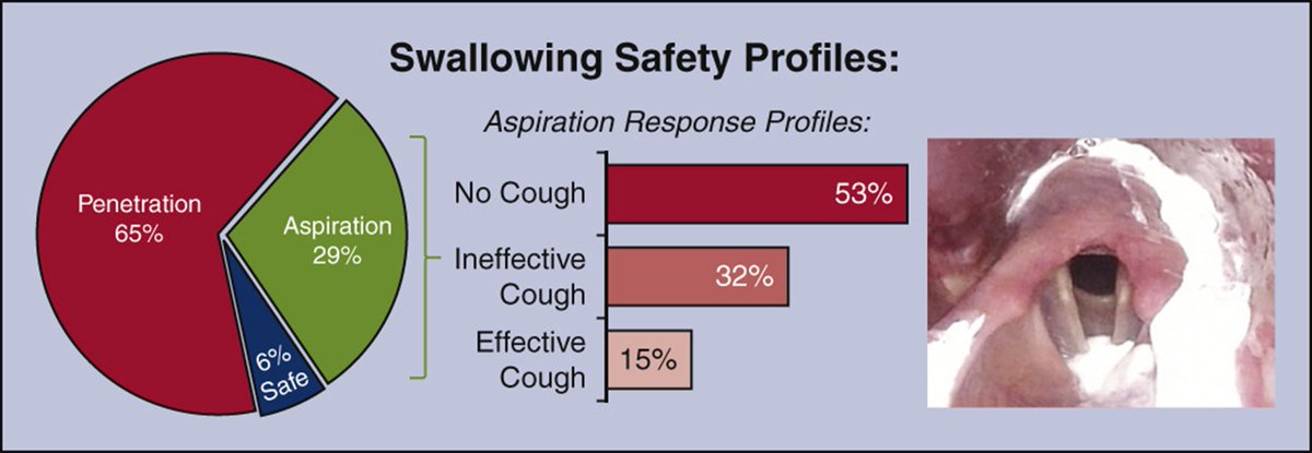 AATSHQ's tweet image. This #TrendingTuesday, we are highlighting the third most cited #JTCVS article from 2023. Read Dysphagia after cardiac surgery: Prevalence, risk factors, and associated outcomes for free: doi.org/10.1016/j.jtcv…

Check in next Tuesday to read the second most cited article.