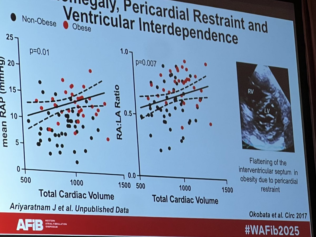 Nishaki Mehta MD (@nishaki1) on Twitter photo Amazing talk by <a href="/PrashSanders/">Prash Sanders</a> at #WAFIB2025
* RA pressure is a marker of pericardial restraint
* They found LA pressure over 15 mm Hg at baseline or after 500 cc saline noted (early HFPEF) in over 70% patients
* Consider including HFPEF in the scores. Amazing talk by <a href="/PrashSanders/">Prash Sanders</a> at #WAFIB2025
* RA pressure is a marker of pericardial restraint
* They found LA pressure over 15 mm Hg at baseline or after 500 cc saline noted (early HFPEF) in over 70% patients
* Consider including HFPEF in the scores.