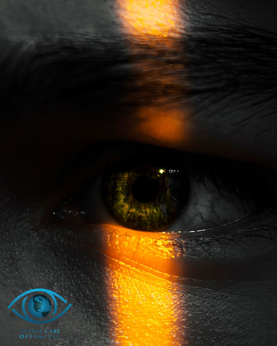 #DidYouKnow? 🌙 Some people are born with a natural ability to see better in low light—a bit like night vision! This is due to a higher concentration of rod cells in their retina.

#optometry #globalcare #eyecare #awareness #careers #eyedoctors #graduates #rewardingcareer