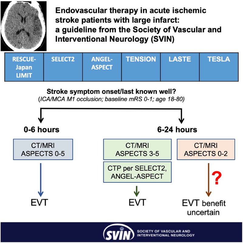Practical recommendations on selection of patients with large infarct for thrombectomy from <a href="/svinsociety/">SVIN</a> <a href="/SVINJournal/">Stroke: Vascular and Interventional Neurology</a> 

Keeping it simple approach minimizes delays to treatment 

⌛️= 🧠

ahajournals.org/doi/10.1161/SV…