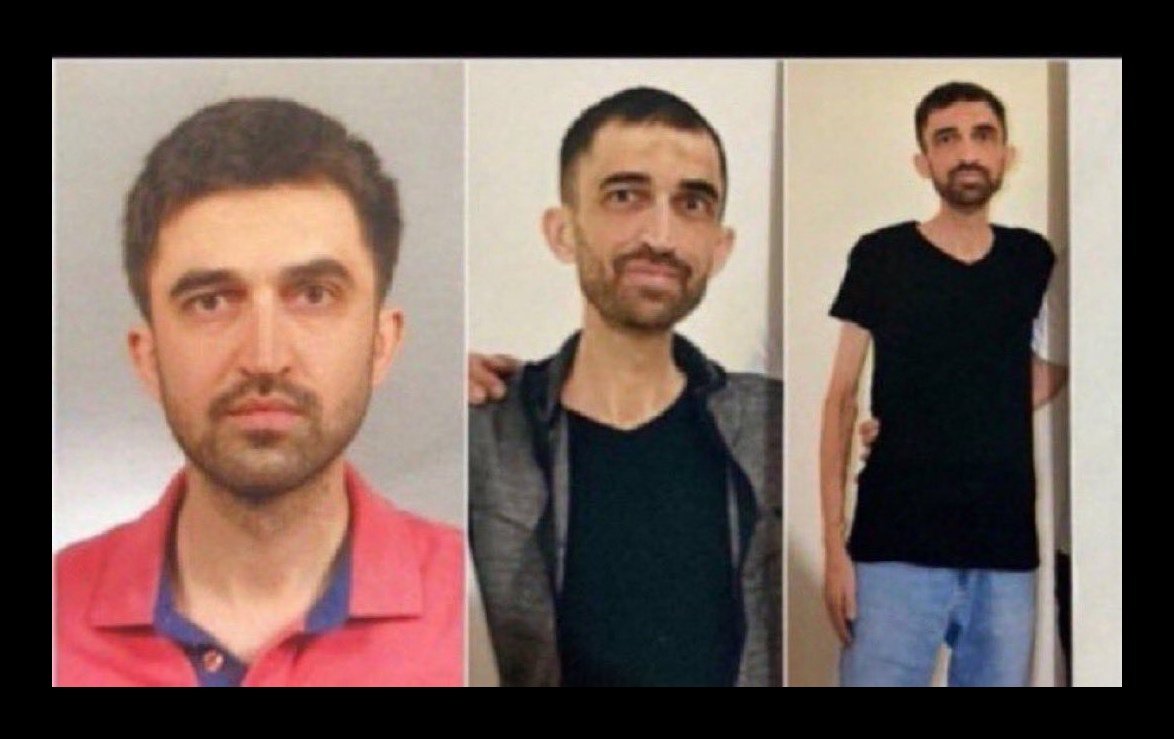 UyumluTris's tweet photo. Sincan 1 nolu Cezaeviʼnde tutuklu bulunan ve 4 yaşından beri böbrek hastası olan Mehmet Parlak bir böbreğini kaybetti, diğer böbreği ise %70 işlevini yitirdi.

Parlakʼın sağlık durumu her geçen gün ağırlaşıyor. Neden hala tahliye etmiyorsunuz? @yilmaztunc

MehmetParlakın SesiOl https://t.co/xRf0ZzGf59
