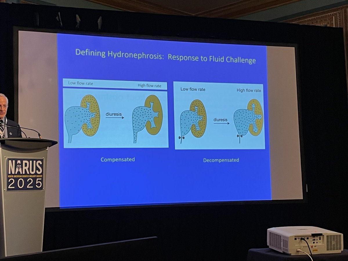 Jessica Hannick (@jhannickmd) on Twitter photo Phenomenal talk by the distinguished <a href="/DrAndrewKirsch/">ANDREW KIRSCH</a> on compensated vs uncompensated UPJO and the utility of MRU with gadolinium for distinguishing surgical vs non-surgical candidates #narus2025 Phenomenal talk by the distinguished <a href="/DrAndrewKirsch/">ANDREW KIRSCH</a> on compensated vs uncompensated UPJO and the utility of MRU with gadolinium for distinguishing surgical vs non-surgical candidates #narus2025