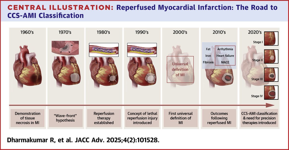 In this #JACCAdvances state-of-the-art review, Dr. Dharmakumar, et al explore advancements &amp; challenges in #cvAMI management. They review 🔑 insights from the prereperfusion era &amp; summarize observations in reperfusion therapy.

Get the details: jacc.org/doi/10.1016/j.… #cvMI