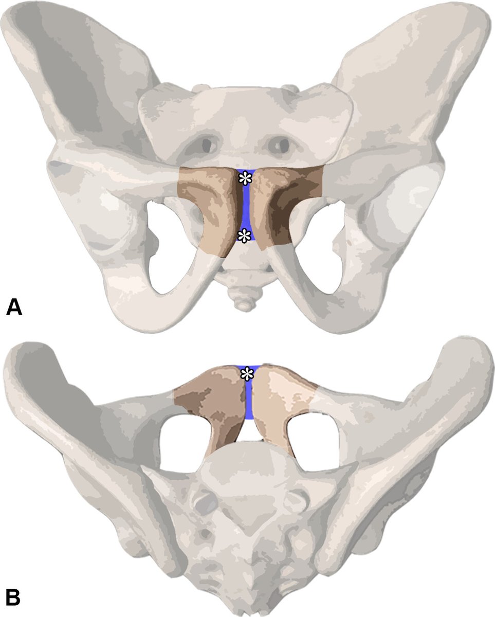 RadioGraphics (@radiographics) on Twitter photo Intimidated by treating the athletic pubalgia or pain at the pubic symphysis? Read further to learn critical anatomy and approach to symphyseography and other symphyseal procedures! pubs.rsna.org/doi/epdf/10.11… @radG_editor Intimidated by treating the athletic pubalgia or pain at the pubic symphysis? Read further to learn critical anatomy and approach to symphyseography and other symphyseal procedures! pubs.rsna.org/doi/epdf/10.11… @radG_editor