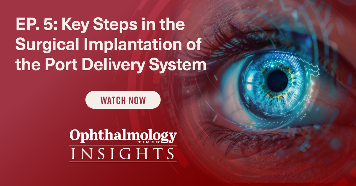 OphthTimes's tweet image. Learn how to implant the port delivery system with Aleksandra Rachitskaya, MD; and Jordan Graff, MD, FACS. Discuss the whole process, from incision to closure techniques, in our next episode.

Watch now: ow.ly/aeCU50V4EoM 

#retina #portdeliverysystem