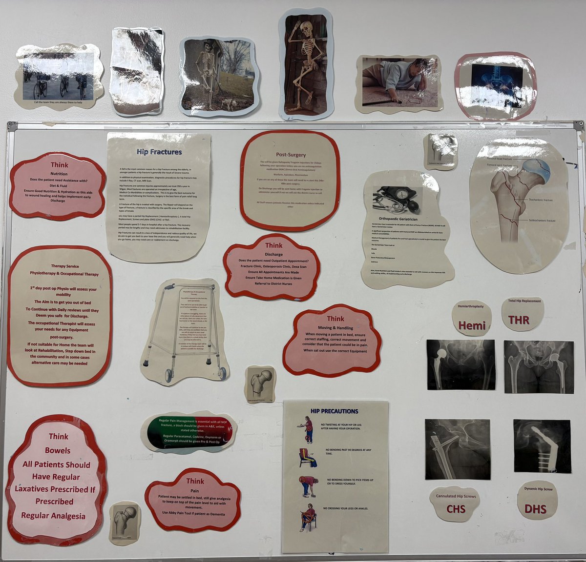 Hip fracture and hip precautions board rejuvenated and ready for training