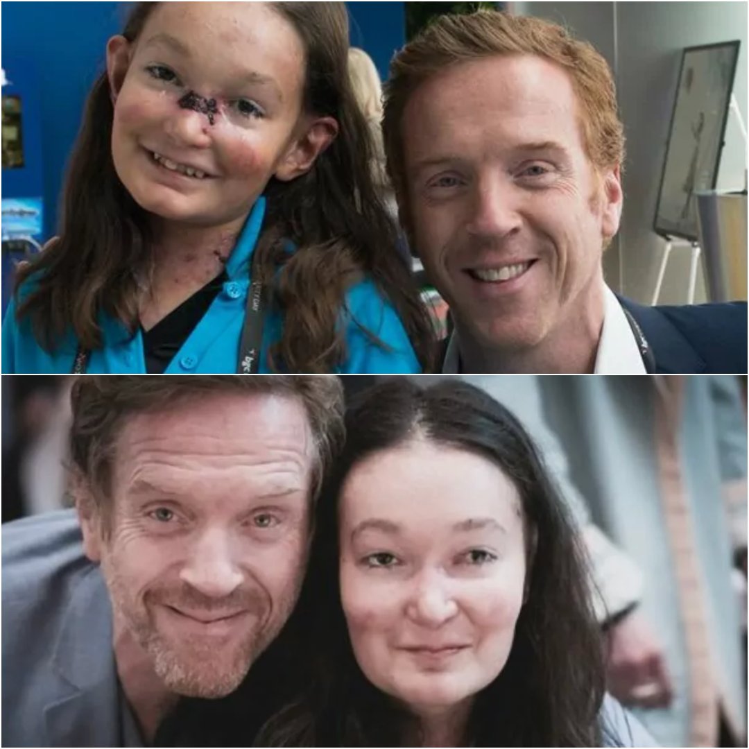 FanFunDamian's tweet photo. #RareDiseaseDay was yesterday but EB is still here today! So do it like #DamianLewis and help @CureEBorg raise awareness/funds for a cure for EB 🦋https://t.co/bkLp20fvkr #CureEB #EBAwareness #RareDiseaseDay #DamianLewis #SohanaCollins #BinkysTimeToFly #RareDiseaseDay2025 https://t.co/FW8qnpPbTc