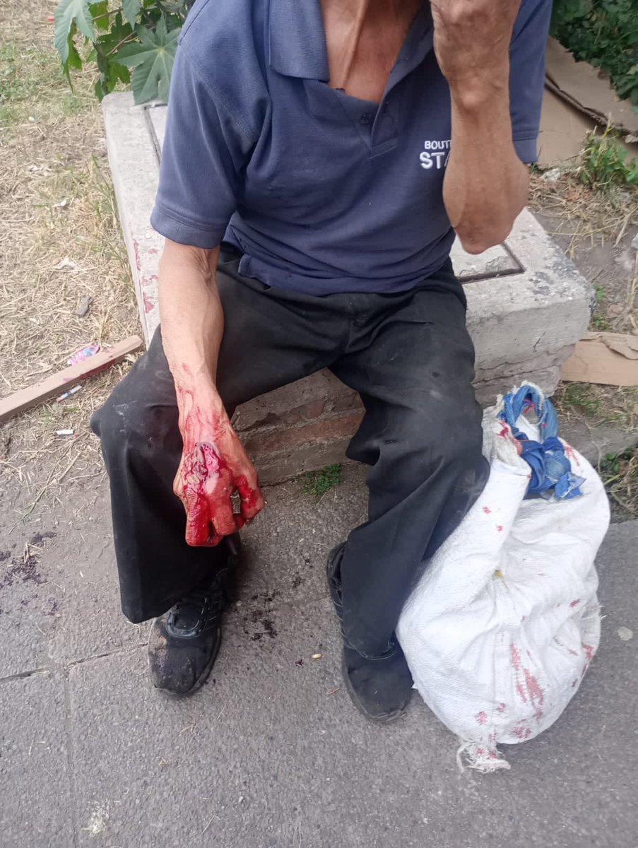 AndresAloi's tweet photo. En la estación Metro Tlaltenco, en @TlahuacPaz un perro agresivo atacó a una persona mayor, sumándose a incidentes previos. En la zona y calles aledañas hay jaurías de perros que  representan un peligro,mientras el àrea se llena de excremento canino.@PAOTmx @C5_CDMX @SEDEMA_CDMX https://t.co/rBFktYNLbI