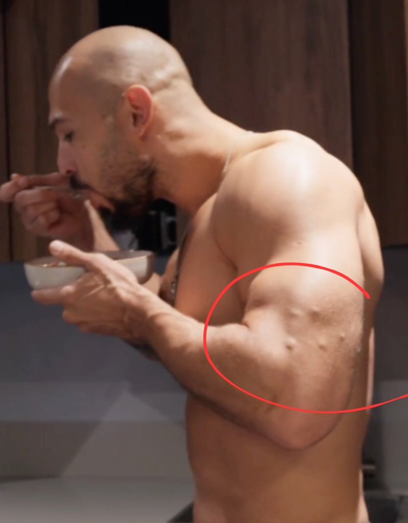 misfitpatriot_'s tweet image. Spoiler alert, it’s called steroids.