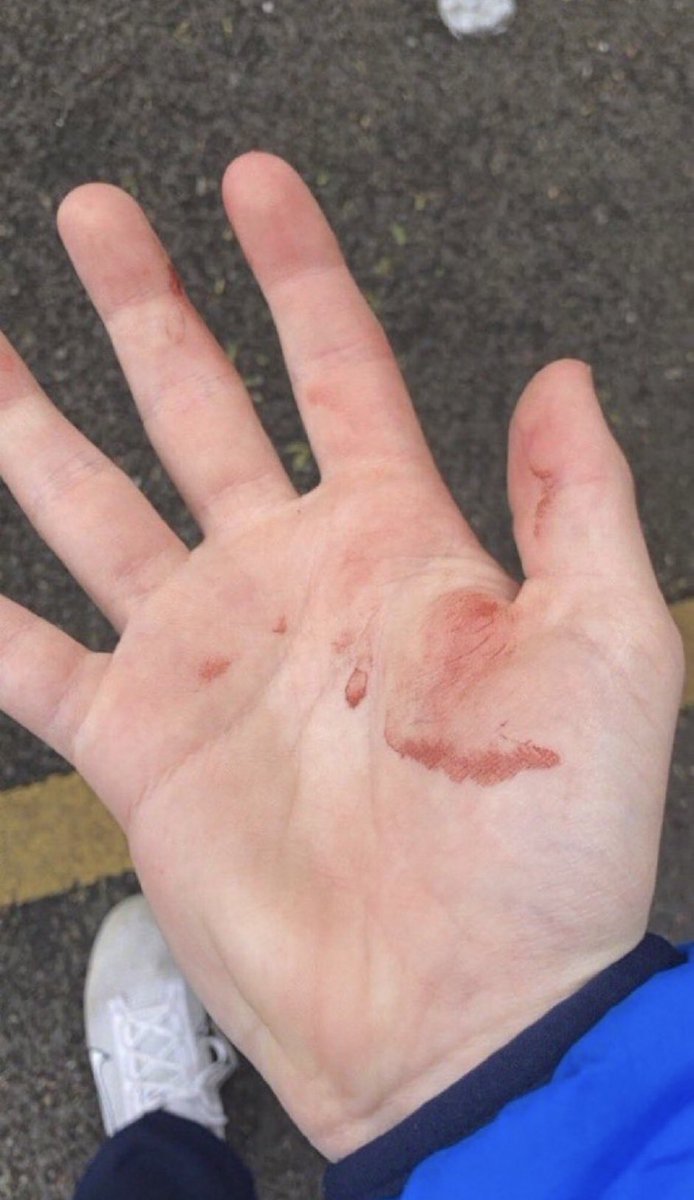 4 Millwall fans down already cmon Palace let’s have em👊🥊 #CPFC