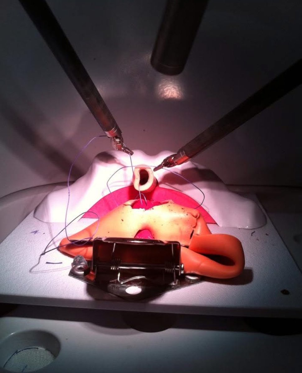 Ricardo Soares (@soares_uro) on Twitter photo Great lecture by <a href="/Ruben_De_Groote/">Ruben De Groote</a> on proficiency based training and ERUS RARP curriculum.
Proud to have been part of the pilot study back in 2014 at <a href="/AalstOlv/">OLV Aalst Urology</a> and <a href="/orsiacademy/">Orsi Academy</a> . All those hours of dry and wet lab training made me a better surgeon.
<a href="/RoboUro/">North American Robotic Urology Society | NARUS</a> #narus2025 Great lecture by <a href="/Ruben_De_Groote/">Ruben De Groote</a> on proficiency based training and ERUS RARP curriculum.
Proud to have been part of the pilot study back in 2014 at <a href="/AalstOlv/">OLV Aalst Urology</a> and <a href="/orsiacademy/">Orsi Academy</a> . All those hours of dry and wet lab training made me a better surgeon.
<a href="/RoboUro/">North American Robotic Urology Society | NARUS</a> #narus2025