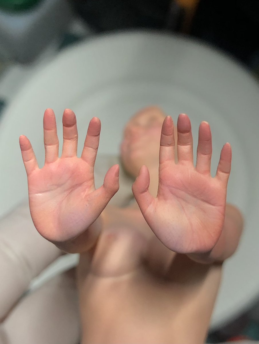 手の平

塗装の考え方は足裏とほぼ同じ

敢えてポイントを言うなら
親指付け根下の紫🟣
リアルな人間でハッキリとわかる人とわかない人がいますが、模型的表現で言うならやっぱり後者をチョイスですね🖐️

まだまだ似たようなポスト続きますが
お付き合いよろしくお願いします！？🫣