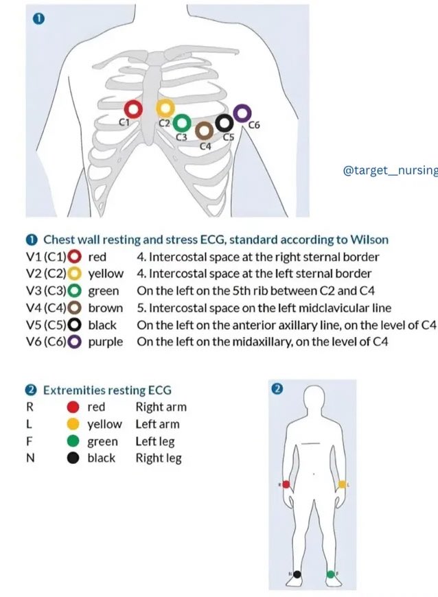 electrode placement