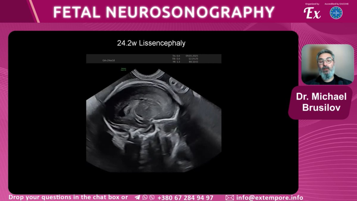 EXTEMPORE tweet media