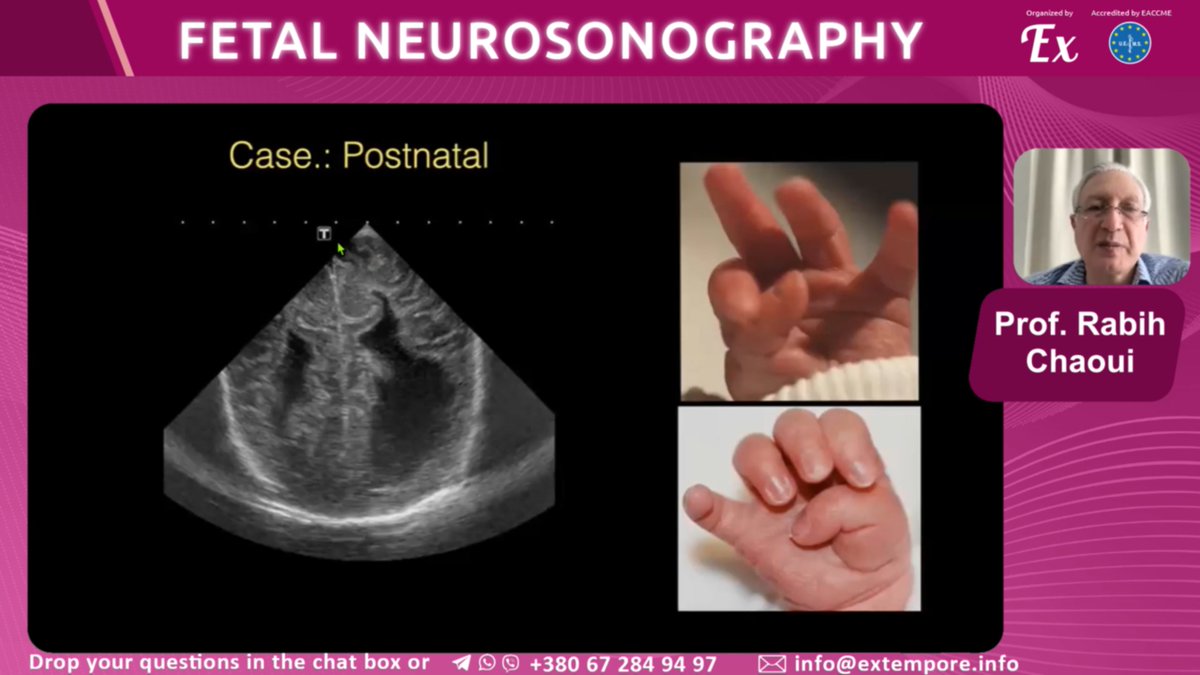 EXTEMPORE tweet media