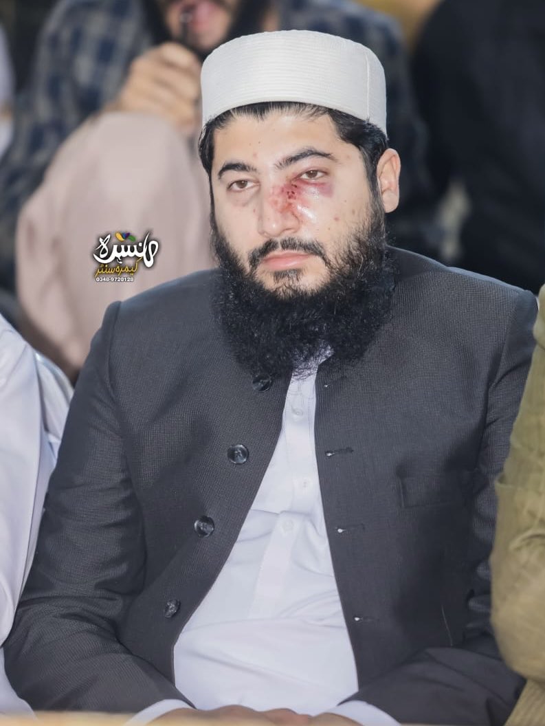 مولانا حامد الحق حقانی اکثر اپنے فون سے پیغامات بھیجتے تھے آج انکے فون نمبر سے انکے بہادر جانشین عبدالحق حقانی کا میسج ملا توایسے لگا کہ حامد الحق حقانی واپس آ گیا ہے عبدالحق حقانی کل کے حملے میں زخمی ہو گئے تھے لیکن اب  اپنے بزرگ مولانا عبدالحق کی طرح صبر کی تصویر نظر آتے ہیں