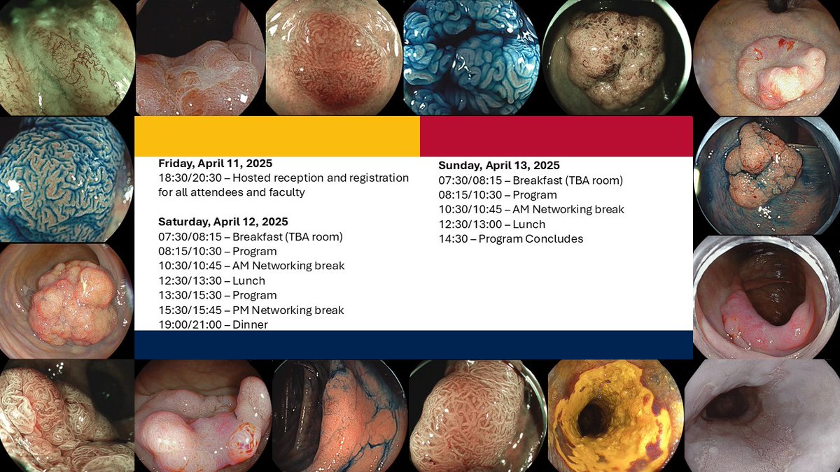 Robert Bechara (@robertbechara) on Twitter photo ๐จ Attention Canadian PGY 4/5 in GI & GenSx ๐จ
Register now for the Annual Queenโs Optical Diagnostic Course: April 11-13 (deadline March 3)
Free registration includes:
โ๏ธTravel stipend
โ๏ธMeals
โ๏ธHotel
Contact for registration:
trina@tallgirlconferenceplanning.com ๐จ Attention Canadian PGY 4/5 in GI & GenSx ๐จ
Register now for the Annual Queenโs Optical Diagnostic Course: April 11-13 (deadline March 3)
Free registration includes:
โ๏ธTravel stipend
โ๏ธMeals
โ๏ธHotel
Contact for registration:
trina@tallgirlconferenceplanning.com