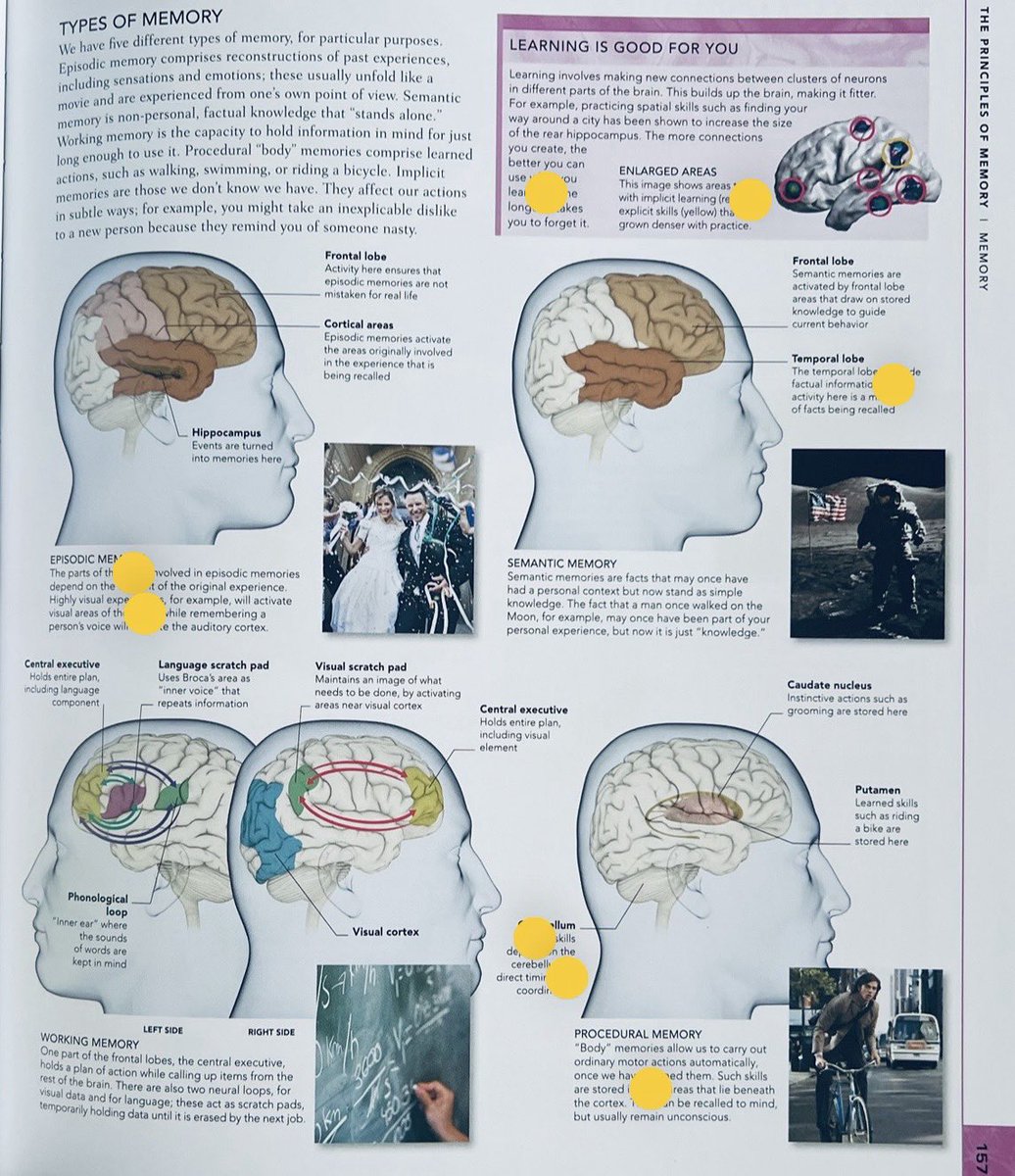 OGdukeneurosurg's tweet photo. Types of memories https://t.co/20JLptaFQ4