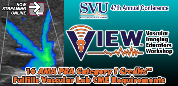 Meetings By Mail (@meetingsbymail) on Twitter photo Just released & NOW STREAMING! The all new Vascular Imaging Educators Workshop features the <a href="/svuinfo/">Society for Vascular Ultrasound</a> 47th Annual Conference. Meet your Vascular Lab CME requirements on your schedule & stay current in vascular #ultrasound! tinyurl.com/yv2u9f94 #OnDemand #MedEd #CME #IAC Just released & NOW STREAMING! The all new Vascular Imaging Educators Workshop features the <a href="/svuinfo/">Society for Vascular Ultrasound</a> 47th Annual Conference. Meet your Vascular Lab CME requirements on your schedule & stay current in vascular #ultrasound! tinyurl.com/yv2u9f94 #OnDemand #MedEd #CME #IAC