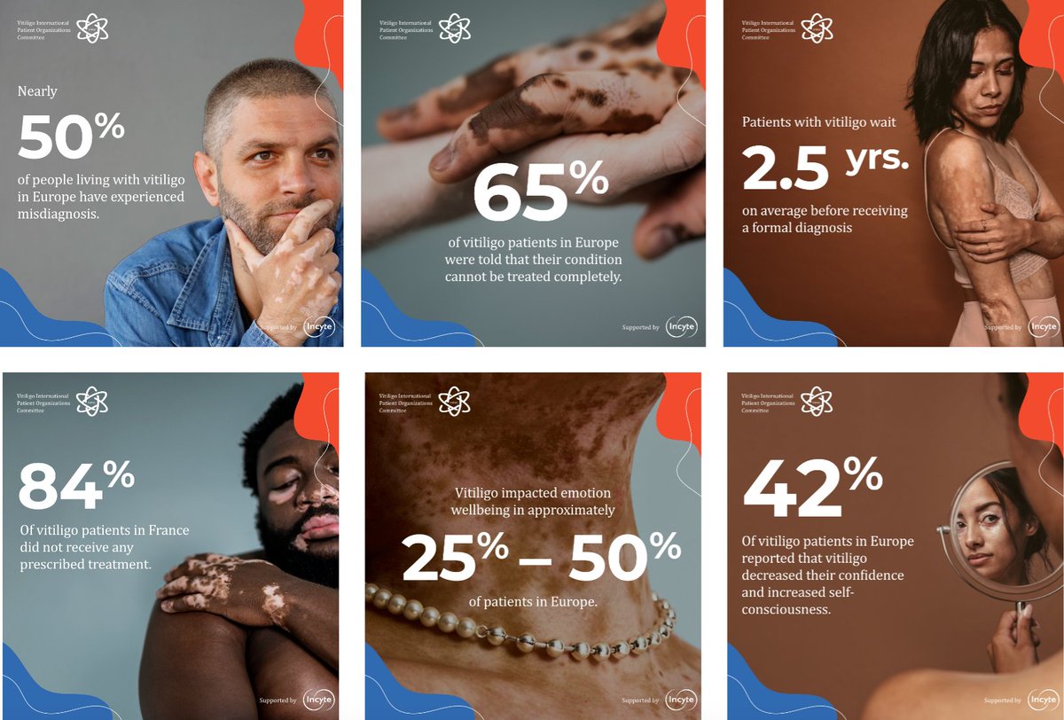 𝐓𝐡𝐞 𝐕𝐈𝐏𝐎𝐂 𝐖𝐡𝐢𝐭𝐞𝐩𝐚𝐩𝐞𝐫 - Rewriting the Vitiligo Patient Experience: Minding the Gaps of the Vitiligo Pathway. 
Here is more linkedin.com/feed/update/ur…
#Vitiligo #VitiligoCare #Healthcare #VitiligoWhitePaper #Dermatology #Skin #VitiligoAwareness #VIPOC #PatientCare