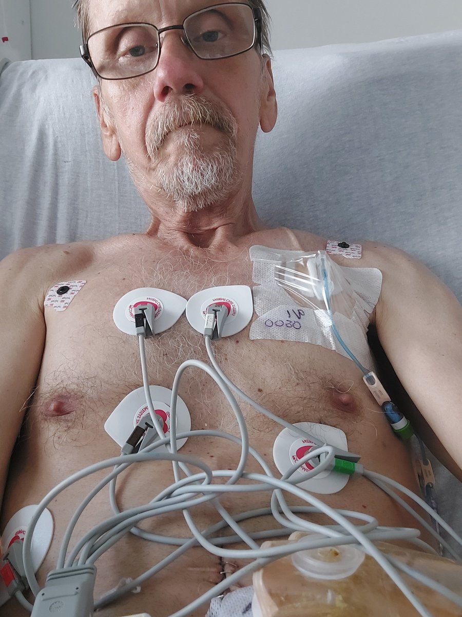 RobertoInYbor's tweet photo. AMERICA !!! I NEED YOUR HELP, Im in Hospice I have 5 months to live, I have Term Cancer, I Need Funds to PAY FOR MY FUNERAL, Please Small or BIG WILL HELP will Help < God BLESS Roberto >I was Rushed TO HOSPITAL LAST WEEK,      https://t.co/zN9DDm7uSU https://t.co/4XLN5q0076