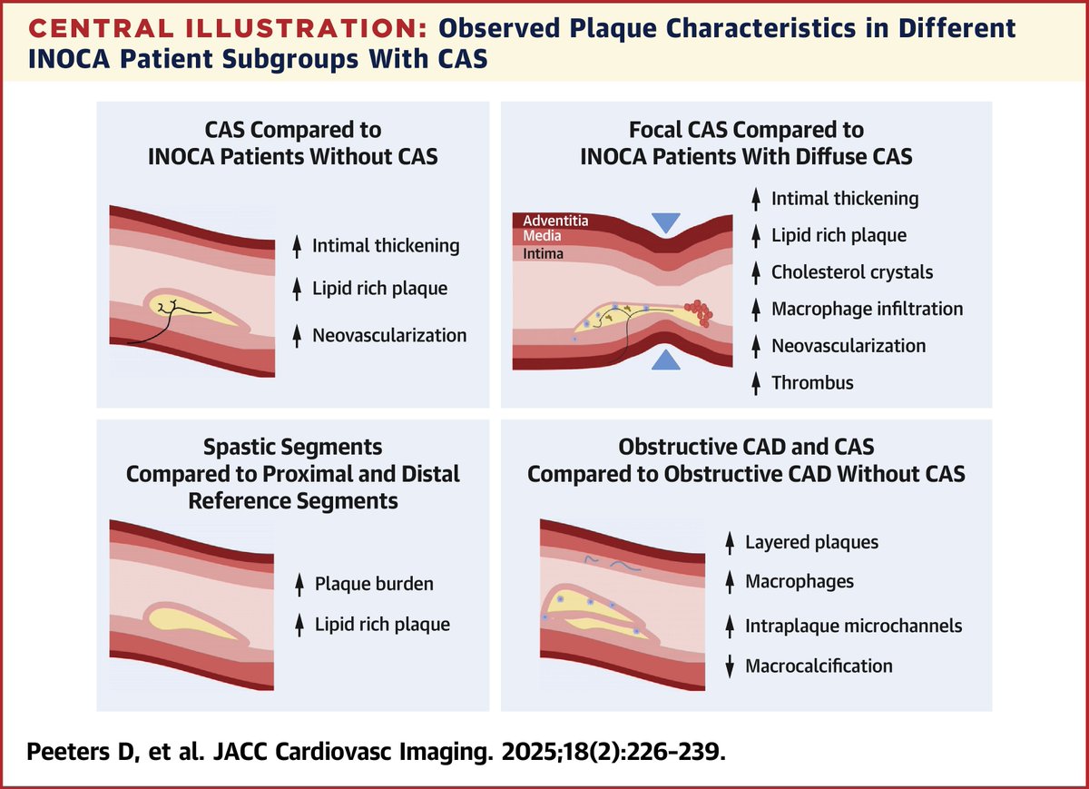 JACCJournals's tweet image. Coronary artery spasm (CAS) is detected in &amp;gt;50% of functional #coronary testing in pts w/ angina/ischemia &amp;amp; nonobstructive coronaries. This #JACCIMG state-of-the-art review explores the association between CAS &amp;amp; #atherosclerosis. jacc.org/doi/10.1016/j.… #cvImaging