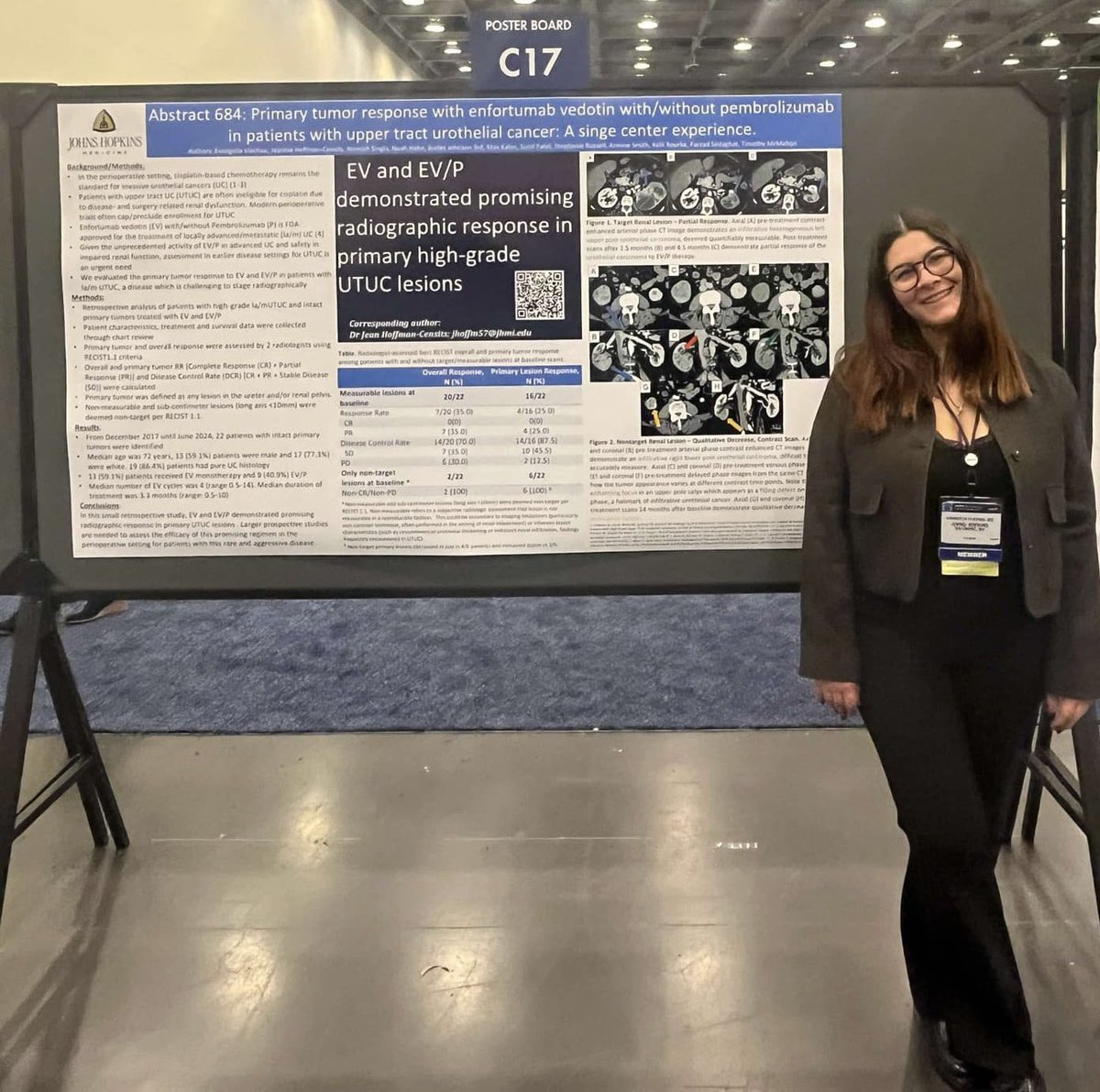 Evangelia (Elina) Vlachou, MD (@elina_vlachou) on Twitter photo It was a great pleasure to present our work with <a href="/JCensits/">Jean Hoffman-Censits</a> on EV & EV/P primary tumor response in pts with UTUC at #asco #GU25 This meeting is one of my favorite times of the year… seeing old friends and making new ones! 🤩 <a href="/PGrivasMDPhD/">Petros Grivas</a> <a href="/DRBakaloudiMD/">Dimitra R. Bakaloudi MD, MS, MPA</a> <a href="/FeinajArdit/">Ardit Feinaj, MD</a> <a href="/SM_Esagian/">Stepan M. Esagian, MD</a> It was a great pleasure to present our work with <a href="/JCensits/">Jean Hoffman-Censits</a> on EV & EV/P primary tumor response in pts with UTUC at #asco #GU25 This meeting is one of my favorite times of the year… seeing old friends and making new ones! 🤩 <a href="/PGrivasMDPhD/">Petros Grivas</a> <a href="/DRBakaloudiMD/">Dimitra R. Bakaloudi MD, MS, MPA</a> <a href="/FeinajArdit/">Ardit Feinaj, MD</a> <a href="/SM_Esagian/">Stepan M. Esagian, MD</a>