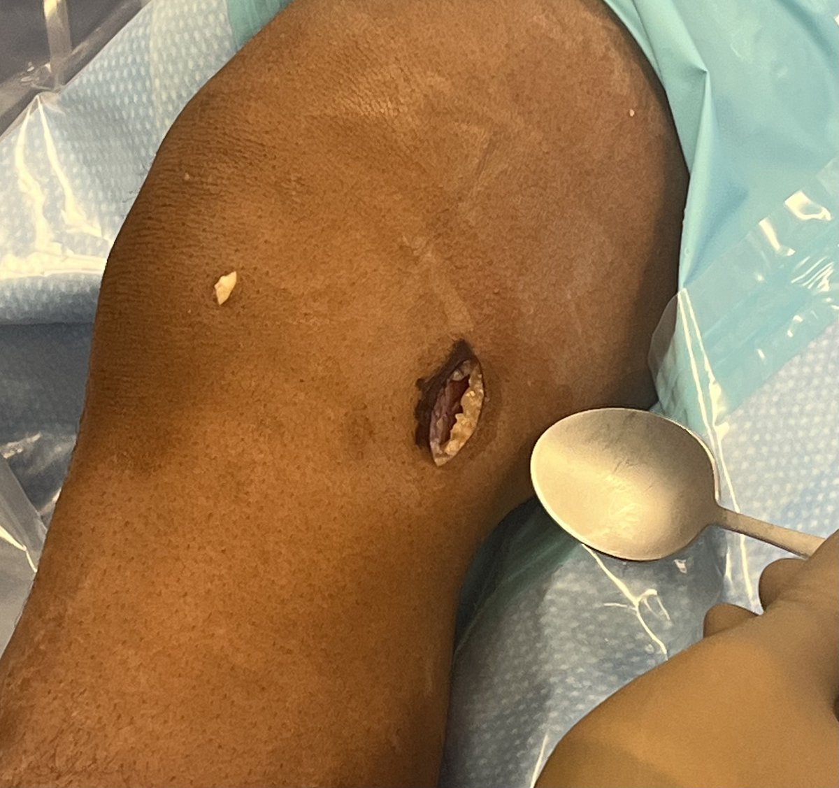 Clayton Nuelle, MD, FAAOS tweet media