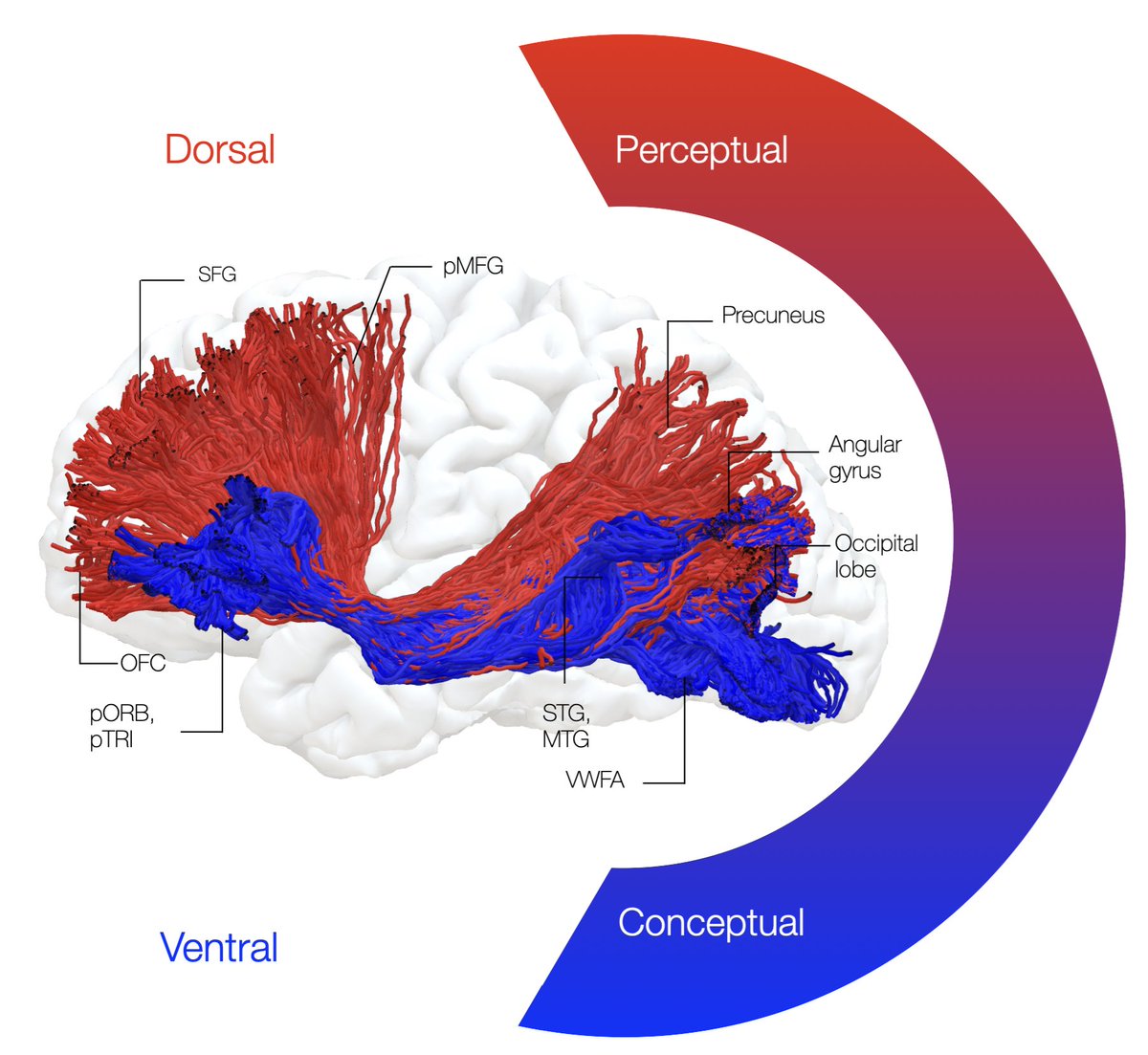 Davide Giampiccolo (@giampiccolod) on Twitter photo 🧵 Excited to share our latest review, published in <a href="/Brain1878/">Brain</a>, on the inferior fronto-occipital fasciculus (IFOF) - full text at the end!
<a href="/UCLIoN/">UCL Queen Square Institute of Neurology</a> <a href="/QSNeurosurgery/">Queen Square Neurosurgery</a> <a href="/uclnews/">UCL News</a> <a href="/CHU_Montpellier/">CHU de Montpellier</a> <a href="/clecliniclondon/">Cleveland Clinic London</a> <a href="/EpilepsyInst/">Epilepsy Research Institute</a> 🧵 Excited to share our latest review, published in <a href="/Brain1878/">Brain</a>, on the inferior fronto-occipital fasciculus (IFOF) - full text at the end!
<a href="/UCLIoN/">UCL Queen Square Institute of Neurology</a> <a href="/QSNeurosurgery/">Queen Square Neurosurgery</a> <a href="/uclnews/">UCL News</a> <a href="/CHU_Montpellier/">CHU de Montpellier</a> <a href="/clecliniclondon/">Cleveland Clinic London</a> <a href="/EpilepsyInst/">Epilepsy Research Institute</a>