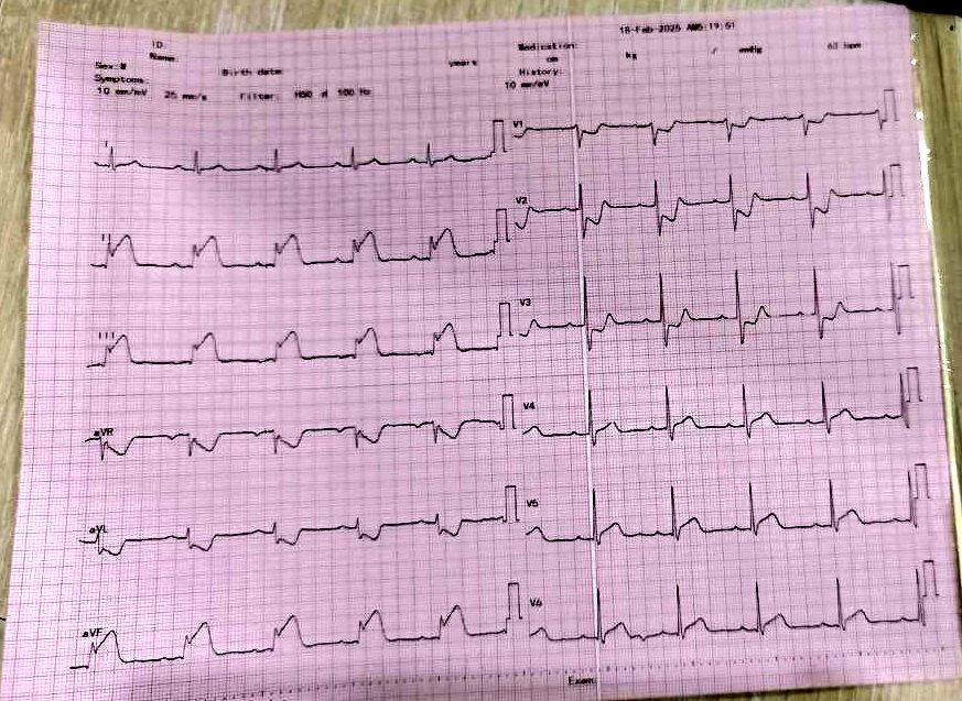 Old man with chest pain