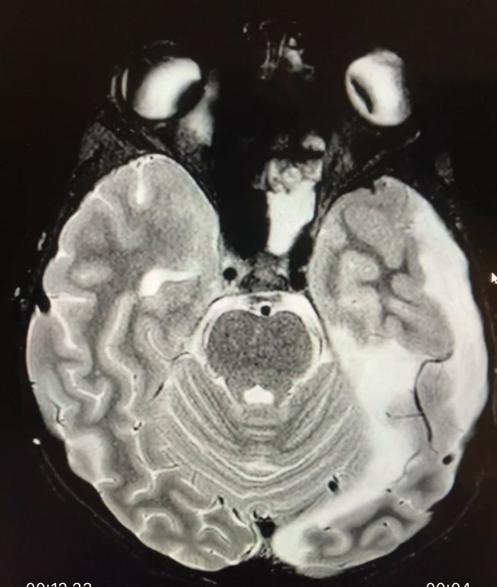 Jason Scott Hauptman MD PhD tweet media