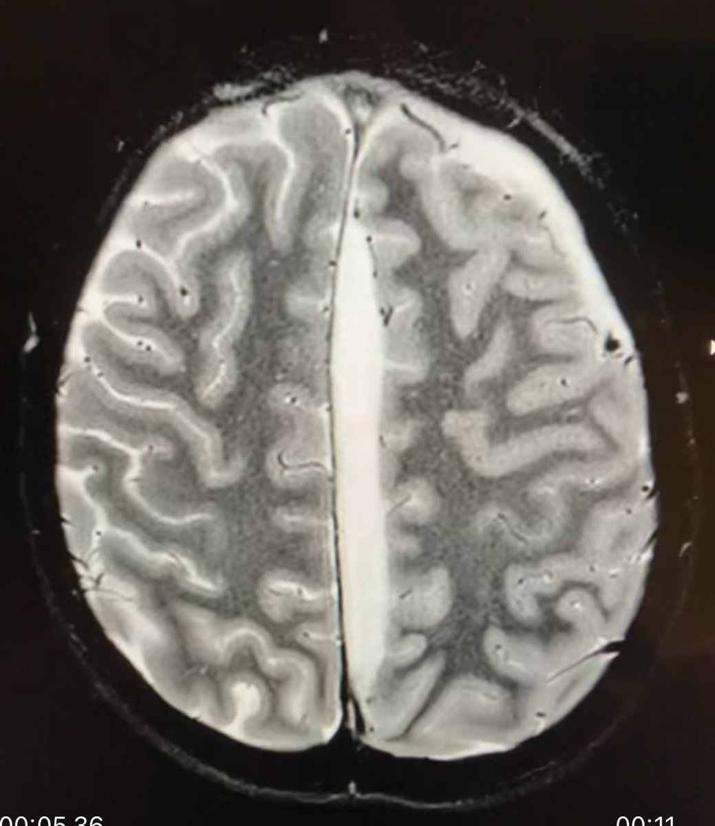 Jason Scott Hauptman MD PhD tweet media