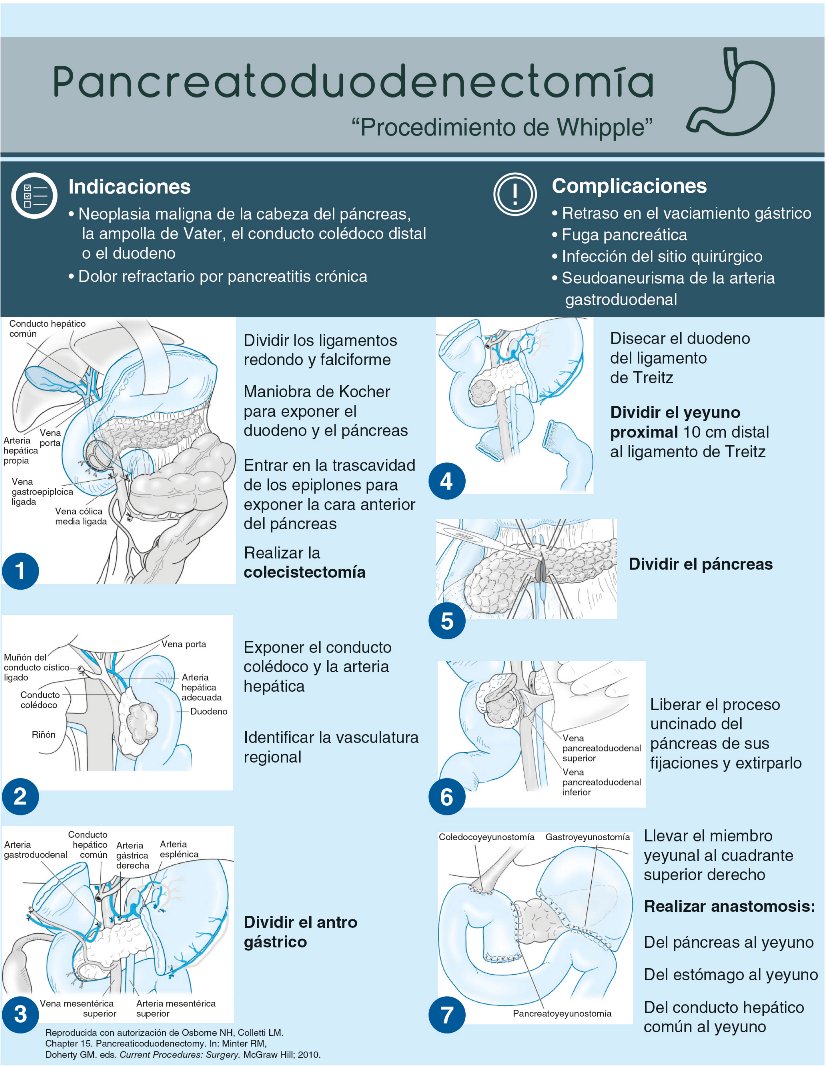 ENARM_intensivo's tweet photo. 💢PANCREATODUODENECTOMÍA
#ENARM_INTENSIVO https://t.co/xIdi8tWBpO
