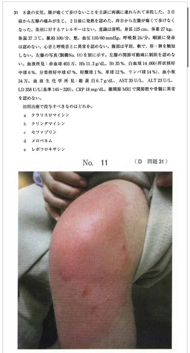 kkamesan's tweet photo. 今年の医師国家試験、整形外科分野の問題も難しいのがそれなりにある。 https://t.co/LQ43BudZl0