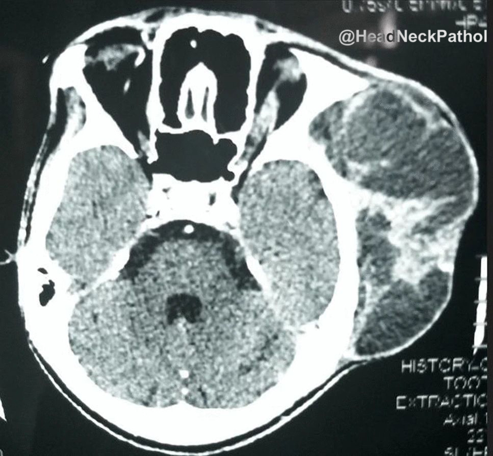 Head Neck Pathol tweet media