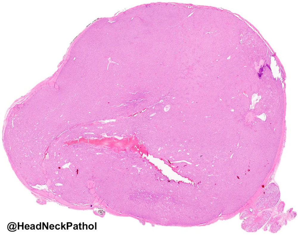 Head Neck Pathol tweet media