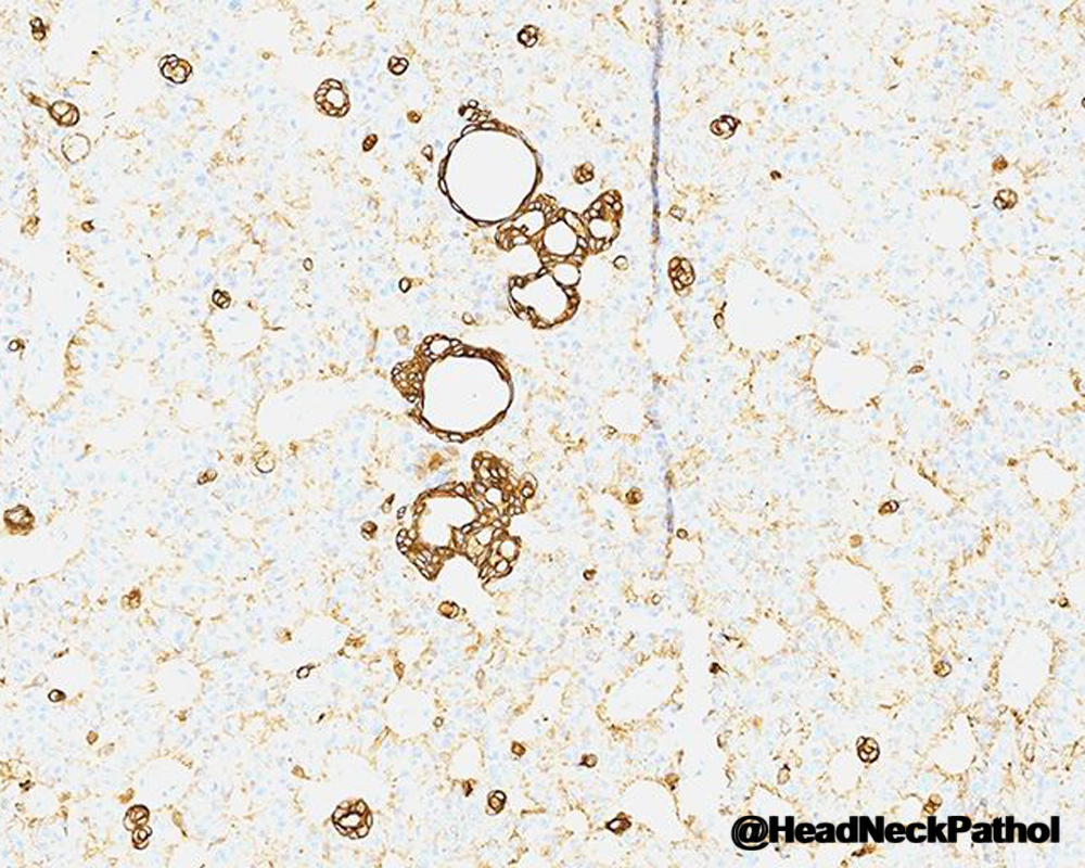 Head Neck Pathol tweet media