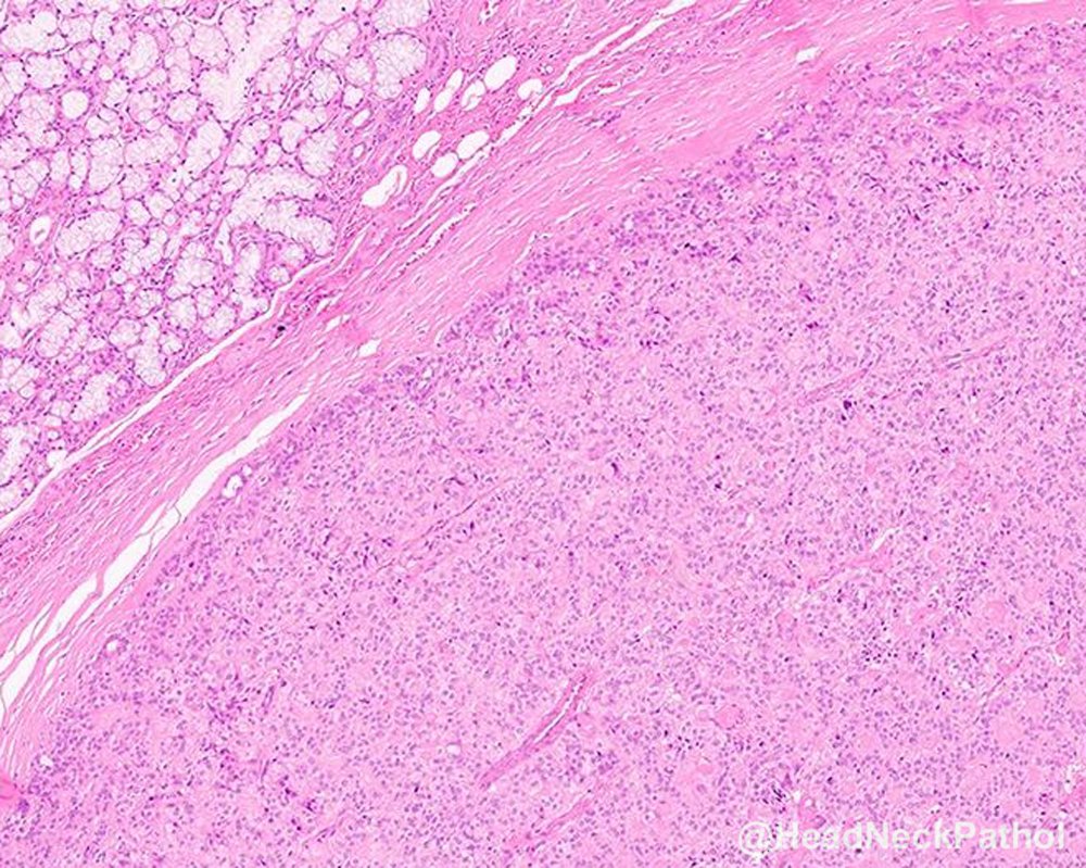 Head Neck Pathol tweet media