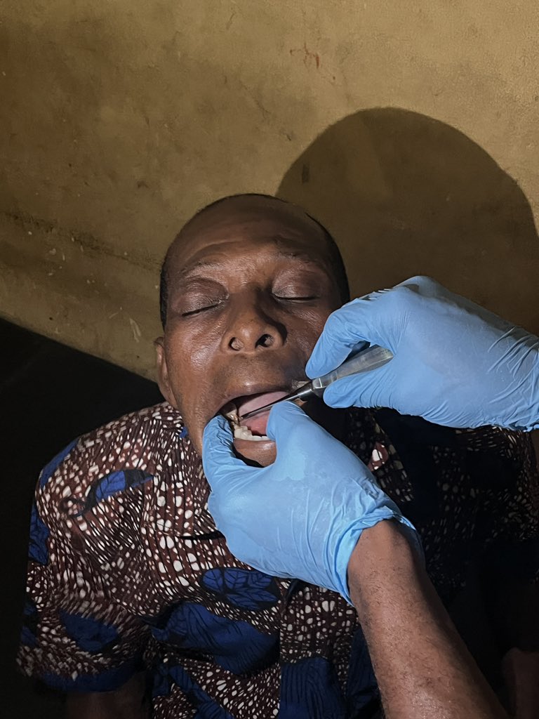 jeff kramer (@3jeffkramer) on Twitter photo Connected with one of the community health volunteers we trained last year, Justice, at Kanuwloe yesterday. Treated over 500 there. For the first time we have dentists with us. Many teeth were pulled! <a href="/PennUltrasound/">Penn Ultrasound</a> <a href="/UPennEM/">Penn EM Residency</a> <a href="/PennGlobalEM/">Penn GEM</a> Connected with one of the community health volunteers we trained last year, Justice, at Kanuwloe yesterday. Treated over 500 there. For the first time we have dentists with us. Many teeth were pulled! <a href="/PennUltrasound/">Penn Ultrasound</a> <a href="/UPennEM/">Penn EM Residency</a> <a href="/PennGlobalEM/">Penn GEM</a>