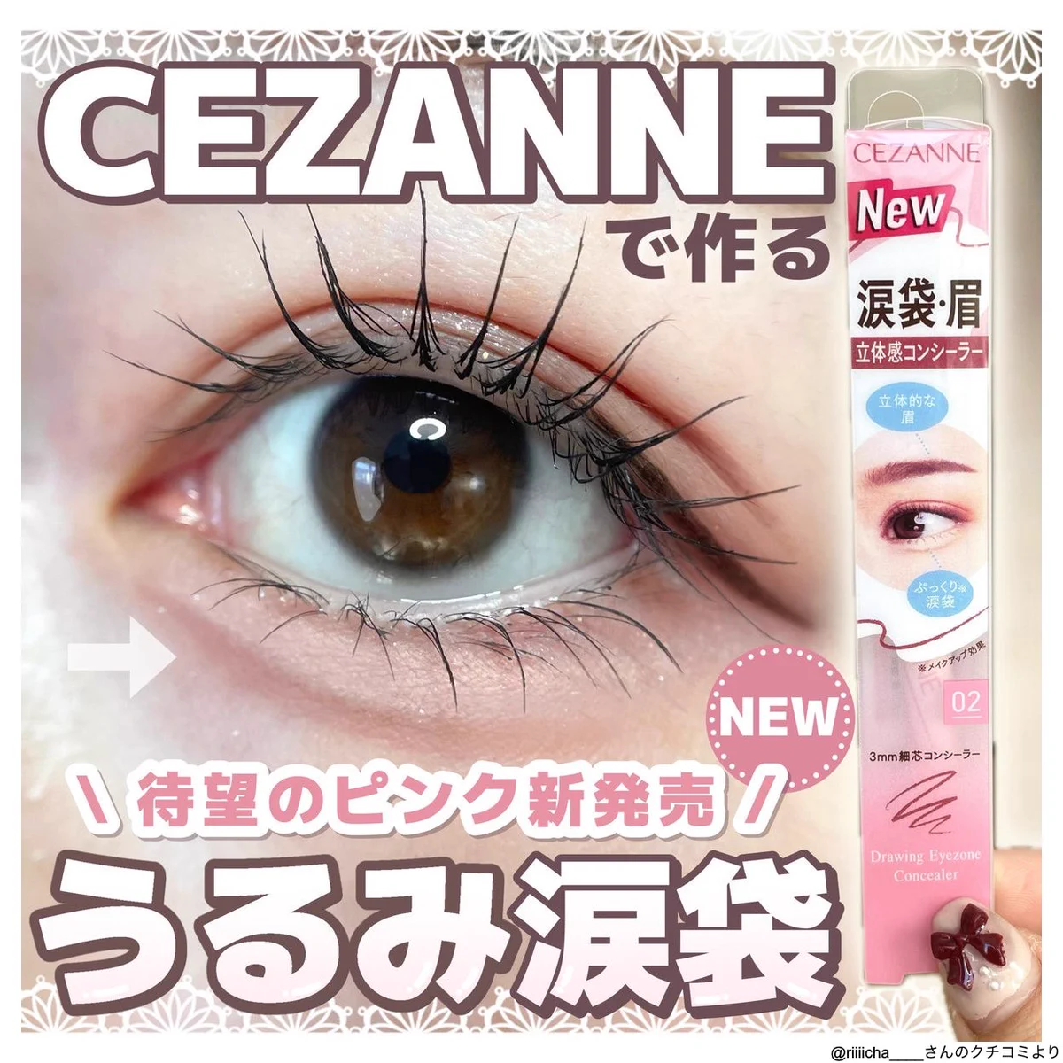 GkDZqctaAAA-LRz?format=webp&