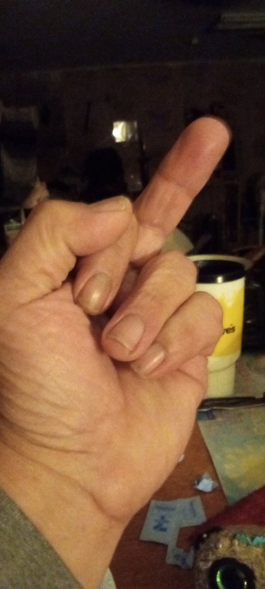 This is to all u fkin scammers u know who u r eating it n whip bitches