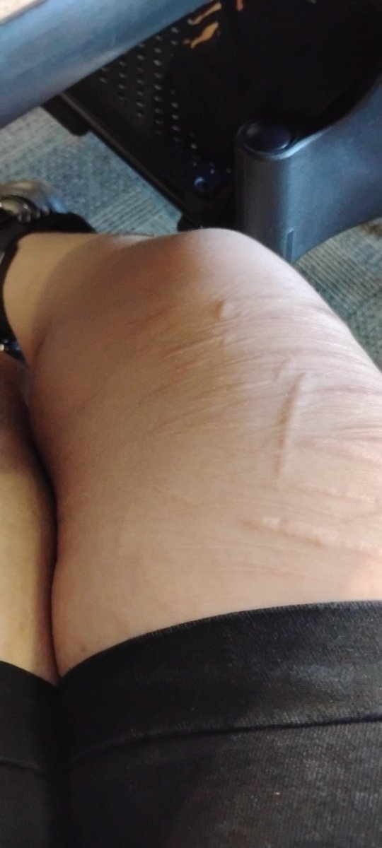 kissherskin's tweet photo. @Anonhatescals if you're fat I'm skinny 🤗🩷 https://t.co/L6KyMSDbSJ