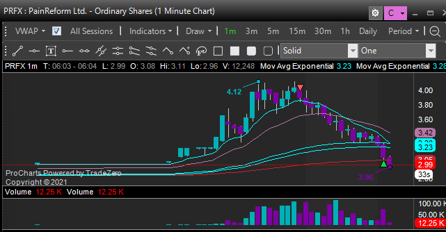 JTrader tweet media