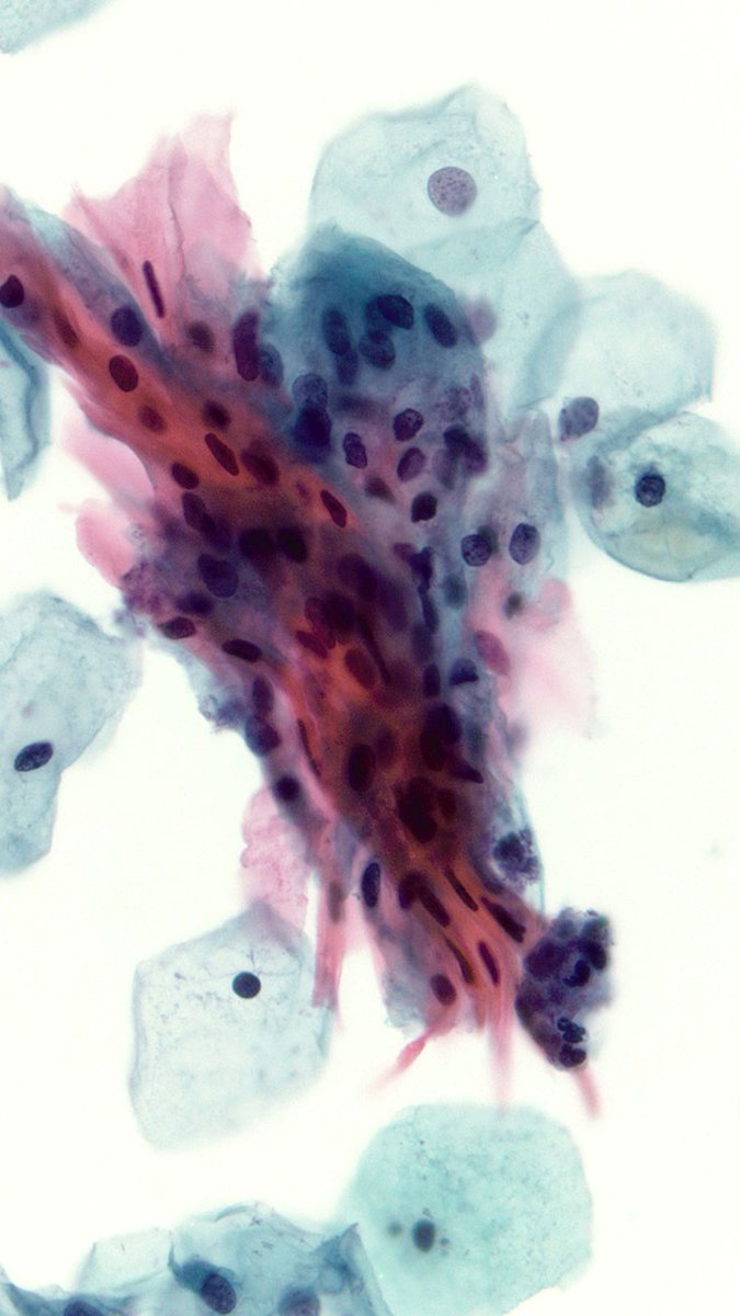 Charlie Herndon tweet media