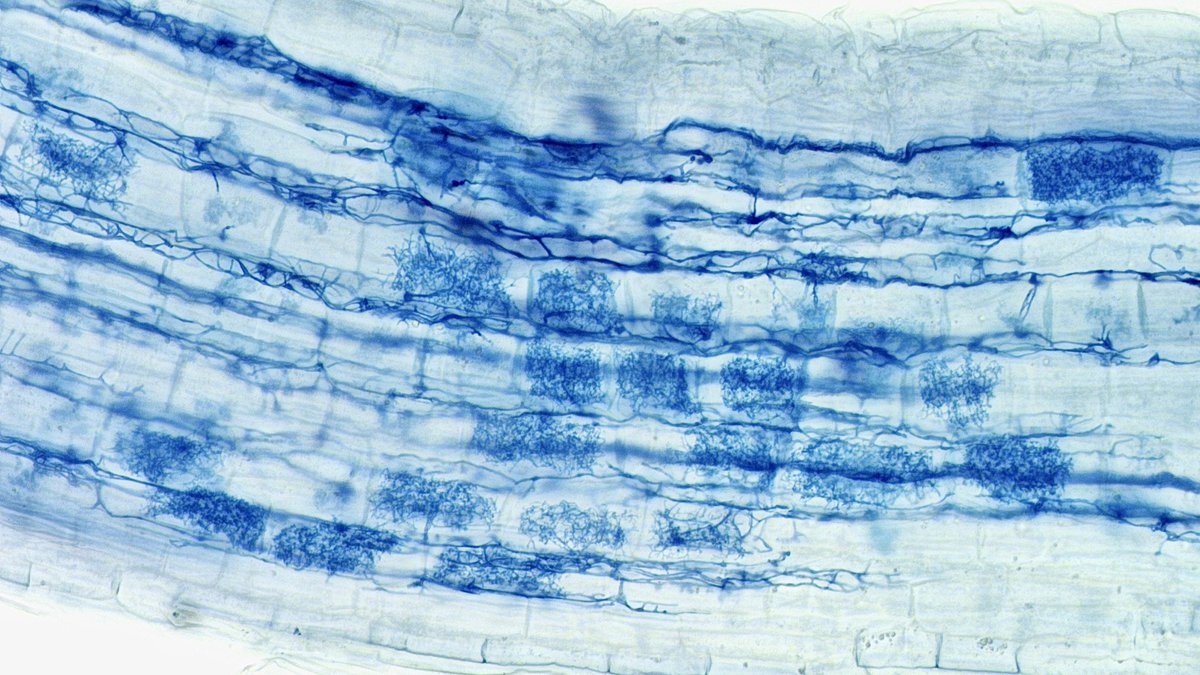 畑に生えているヒメジョオンの根にも菌根菌は共生しています。根ごと引き抜いて捨てるのは勿体ないのです。
因みに画像はfine root endophyteの樹枝状体。